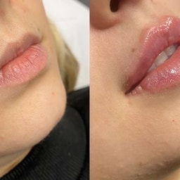 Diorlashes