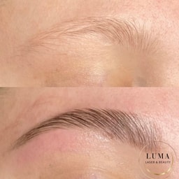 LUMA Laser & Beauty