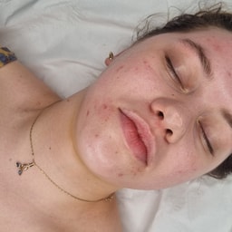 Rose Beauty and skincare
