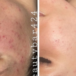 Beautybar424