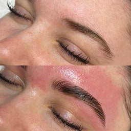 Skin By Summer