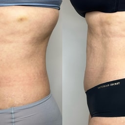 TS Browshes Esthetics and Laser