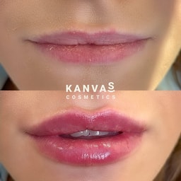 Kanvas Medical Group