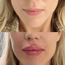 New You Cosmetic Centre