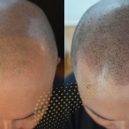 AMEIRO Scalp Ink