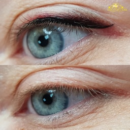 Senses Hudklinikk