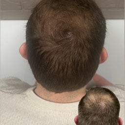 MHP Hair Solutions