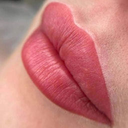 Dermafrance