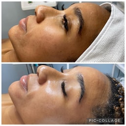 Fresh Skin Studio