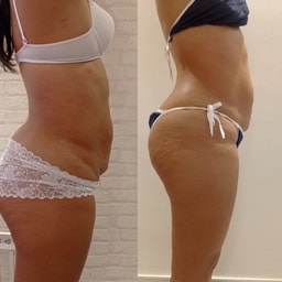 Lovelly Spa - Estetica Integral