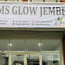 Ms Glow Jember